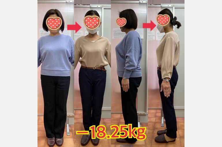 ビフォーアフター