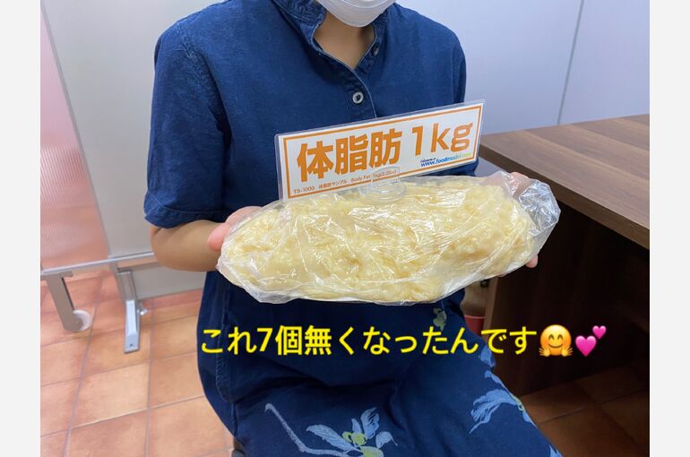 脂肪７kg落ちた